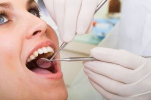 Preventing Cavities